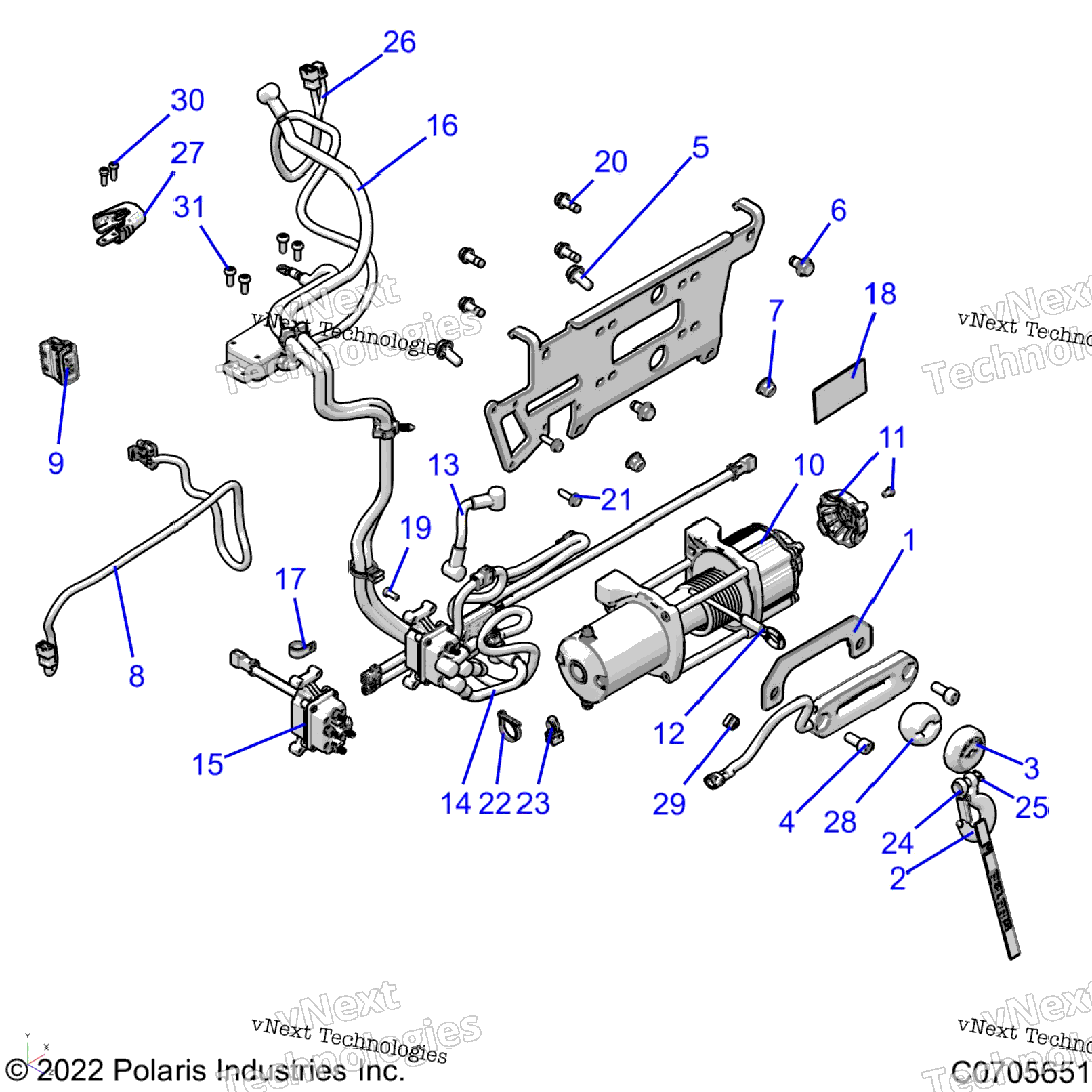 Body, Winch